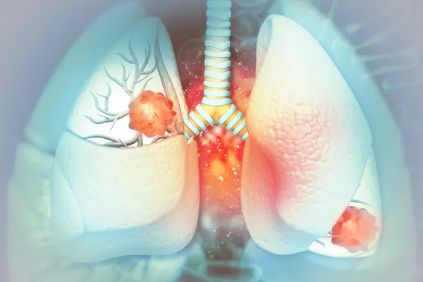 Bronchogen Peptide in Pulmonary Fibrosis Studies 1 Bronchogen Peptide in Pulmonary Fibrosis Studies