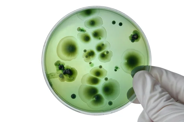 Fighting Fungal Infections with TA1 Peptide
