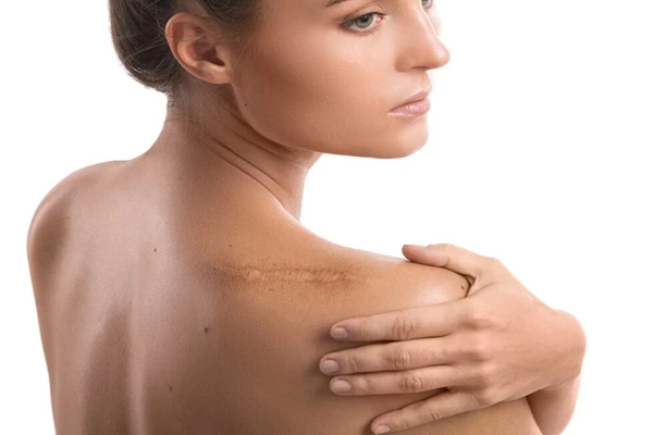 What are the Best Tissue Repair Peptides? 1 Best Tissue Repair Peptides