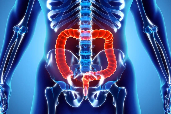 VIP Intestinal Peptide